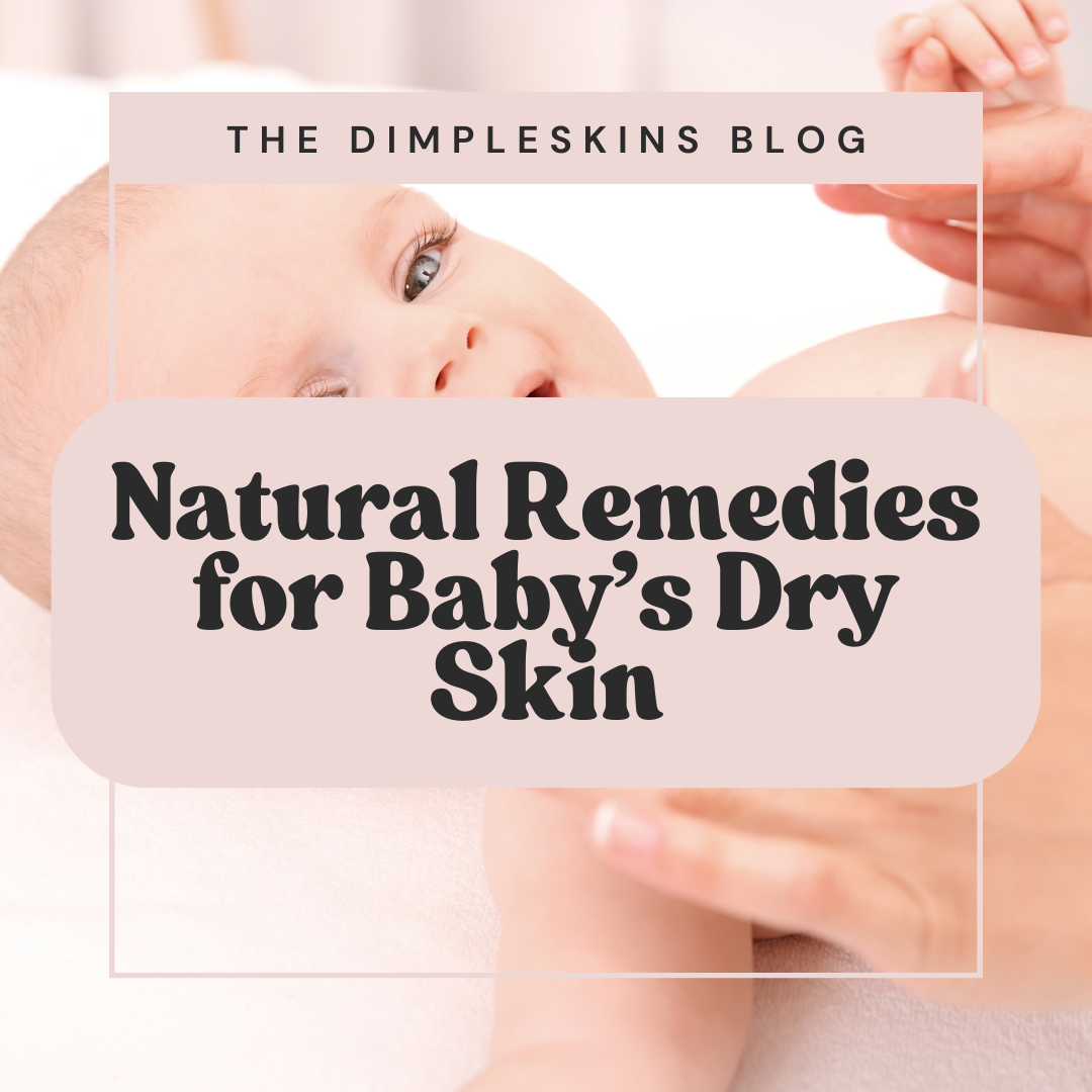 Natural Remedies and Gentle Relief for Baby's Dry Skin