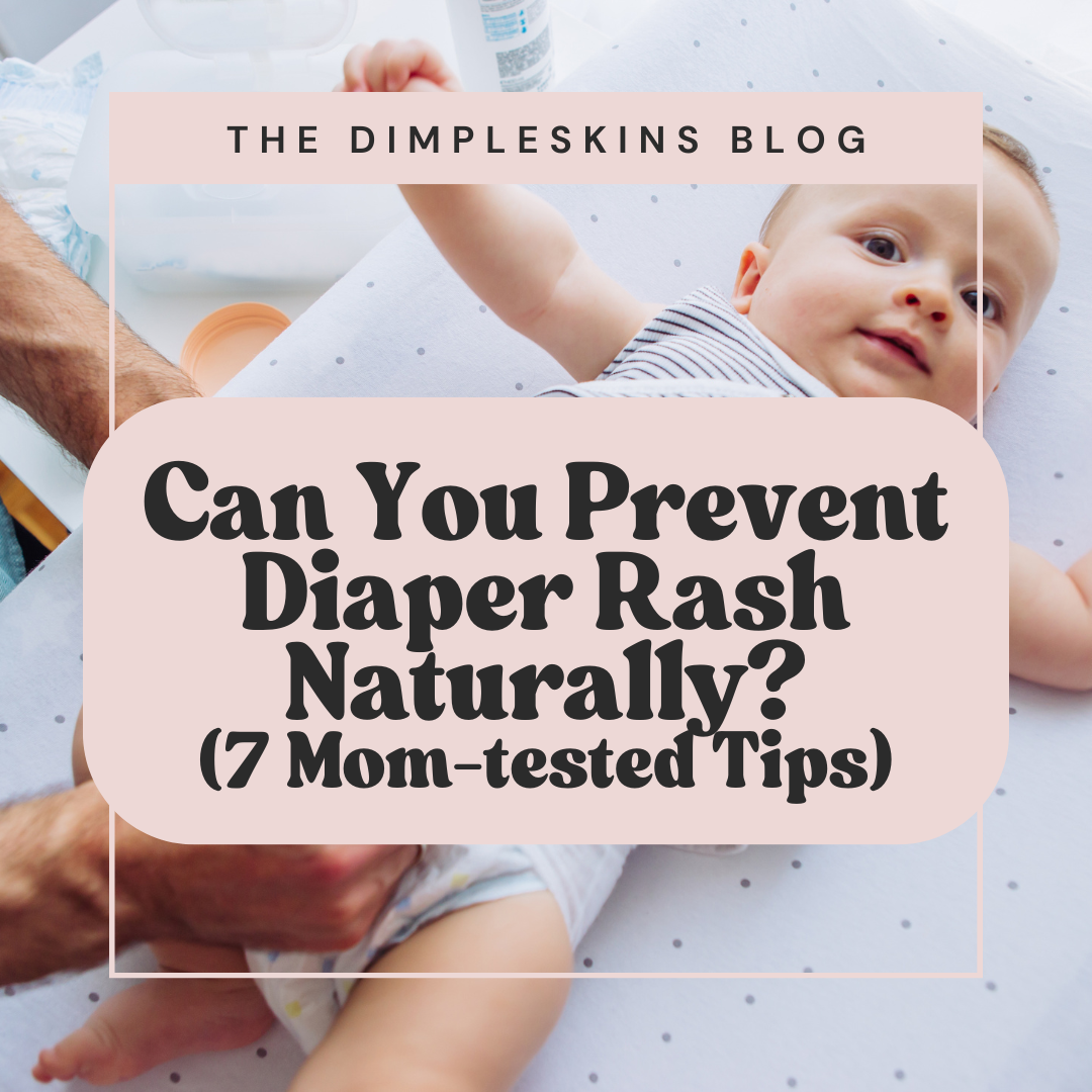 Can You Really Prevent Diaper Rash Naturally? (7 Mom-Tested Tips)