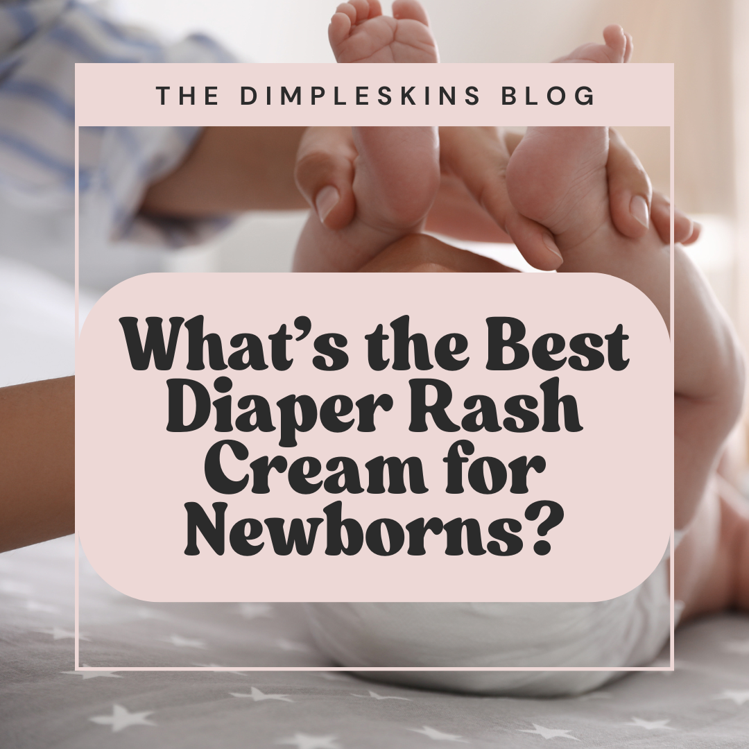 What's the Best Diaper Rash Cream for Newborns?